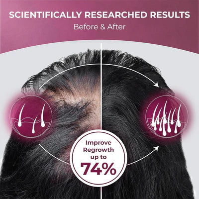 PureHealth Research ReGrow – Hair Supplement with Saw Palmetto (120 Capsules)